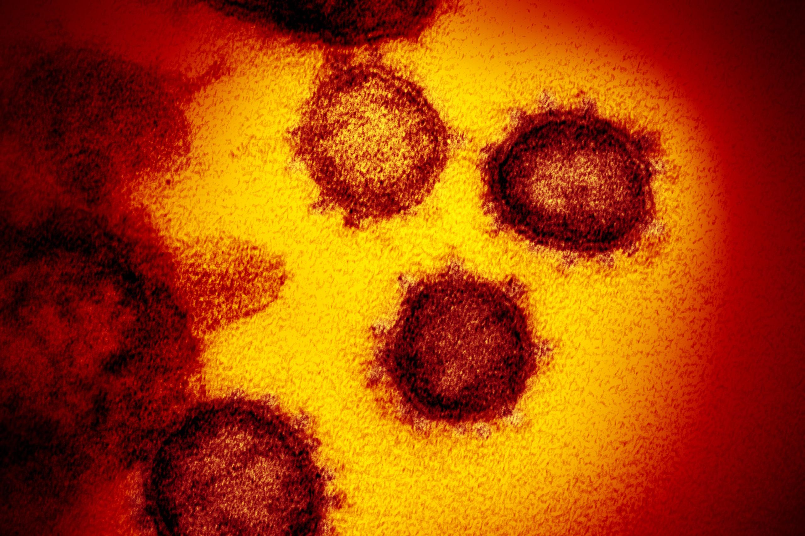Международная группа ученых выпустила заявление, в котором призвалa не верить фейкам о лабораторном происхождении коронавируса