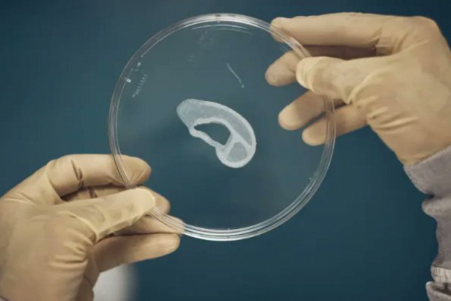 Новое ухо: в США врачи впервые в мире пересадили орган, напечатанный на 3D-принтере