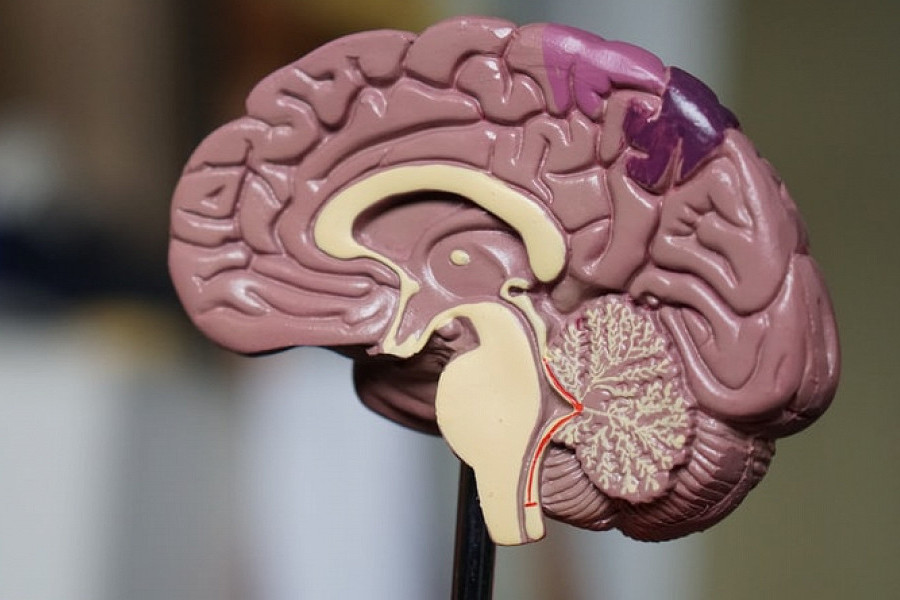 COVID-19 может оказывать длительное воздействие на мозг и стать причиной болезни Альцгеймера: исследование 