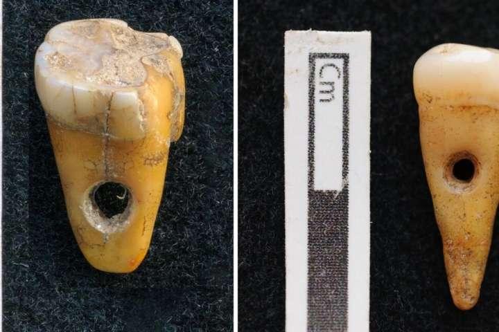 Редкая находка: во время раскопок в неолитическом поселке Чатал-Хююк в Турции обнаружены «бусины» из человеческих зубов  