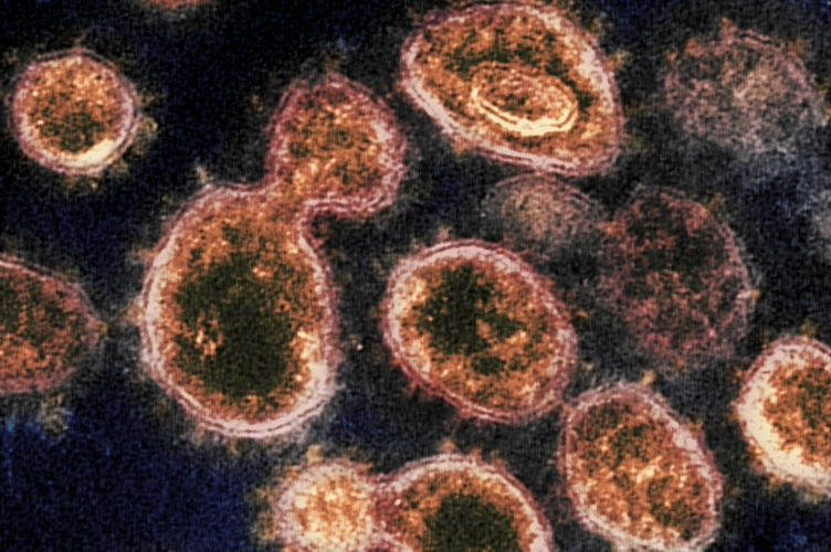 Экстракт водорослей в 9 раз эффективнее блокирует коронавирус, чем ремдесивир: исследование 