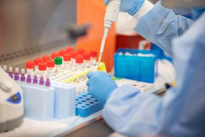 До настоящего времени в Республике Арцах не зарегистрировано ни одного случая коронавирусной инфекции