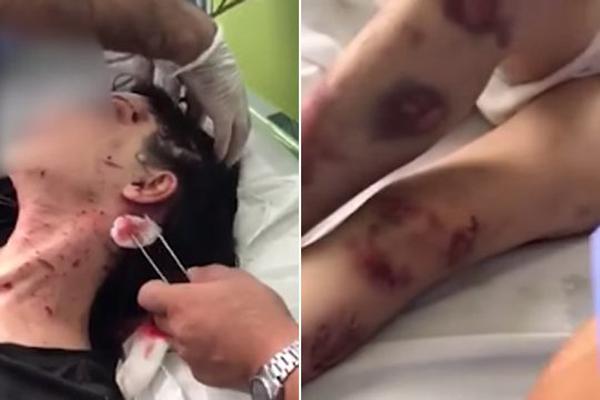 Захваченная накануне в заложники девушка пока останется в реанимационном отделении