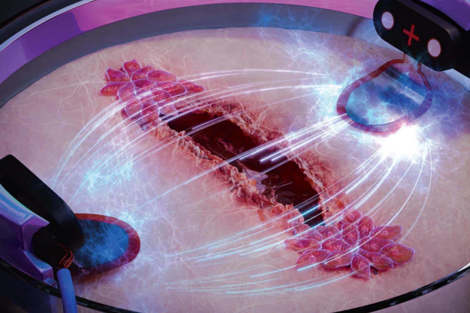 Медицина будущего: исследователи разработали метод заживления ран втрое быстрее с помощью электричества