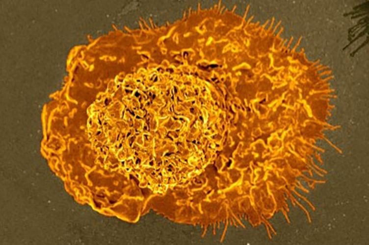 Scientific American: Недавно открытые иммунные клетки могут помочь безопасно пережить легочную инфекцию, вызванную коронавирусом