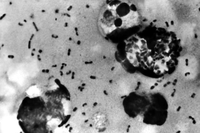 Европейские ученые полагают, что смогли наконец установить, откуда в середине XIV века начала распространение эпидемия бубонной чумы
