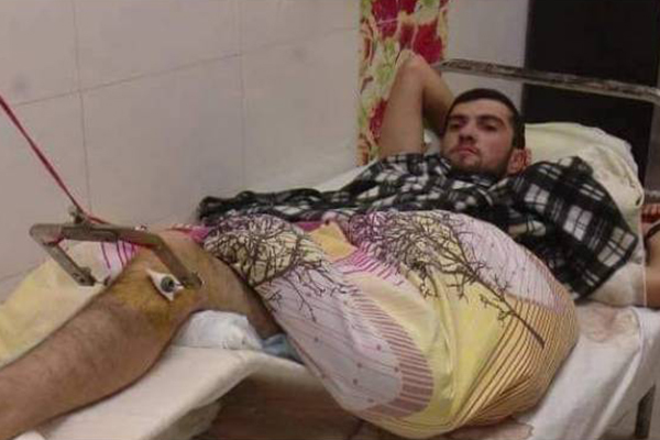 Азербайджанскому военнопленному Юлсийву Нурадин Бахтияроглу в Арцахе была оказана медицинская помощь