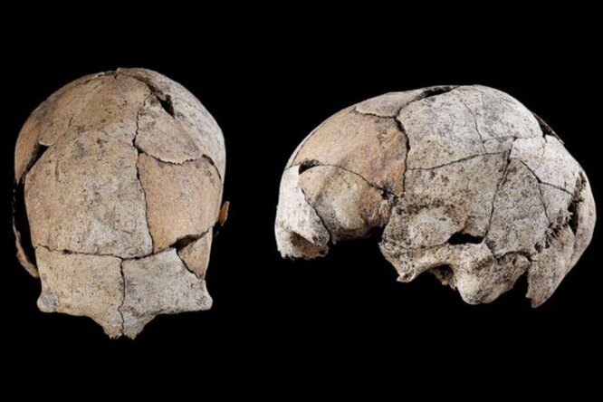 Обнаружен 5300-летний череп со следами древнейшей хирургической операции на ухе