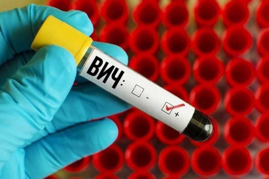 Россию назвали лидером по темпам распространения ВИЧ в Европе