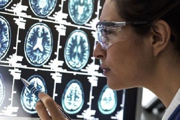 Новый препарат показал эффективность в борьбе против болезни Альцгеймера