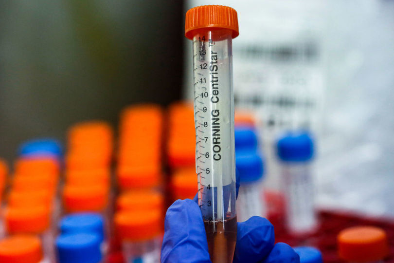 В Грузии впервые с 26 февраля не зафиксировано ни одного нового случая заражения коронавирусом