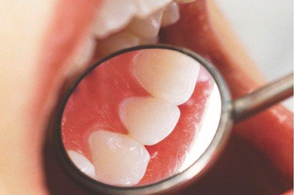 Интересно знать: стоматология прошлого или зубная «мода» разных эпох
