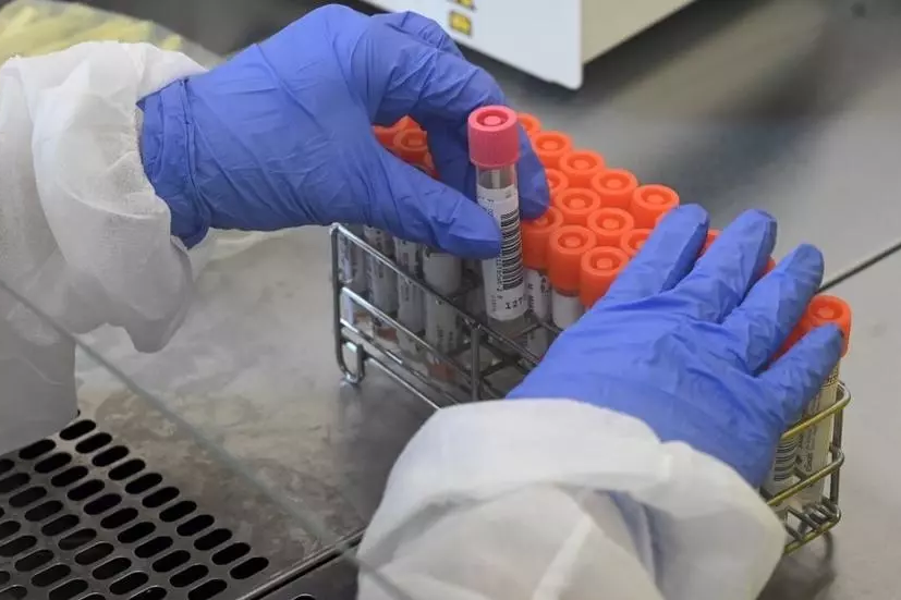 Во Франции продолжает снижаться число пациентов в больницах и в частности в реанимационных отделениях