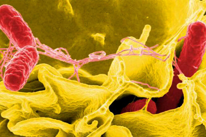 Столкнувшись с бактериальными захватчиками, некоторые человеческие клетки оказались способными выделять… мыло