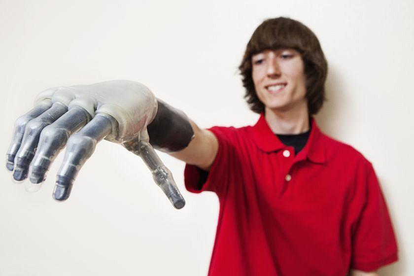 Пациенты смогут управлять протезом руки благодаря беспроводным имплантам: ученым удалось доказать эффективность инвазивных сенсоров