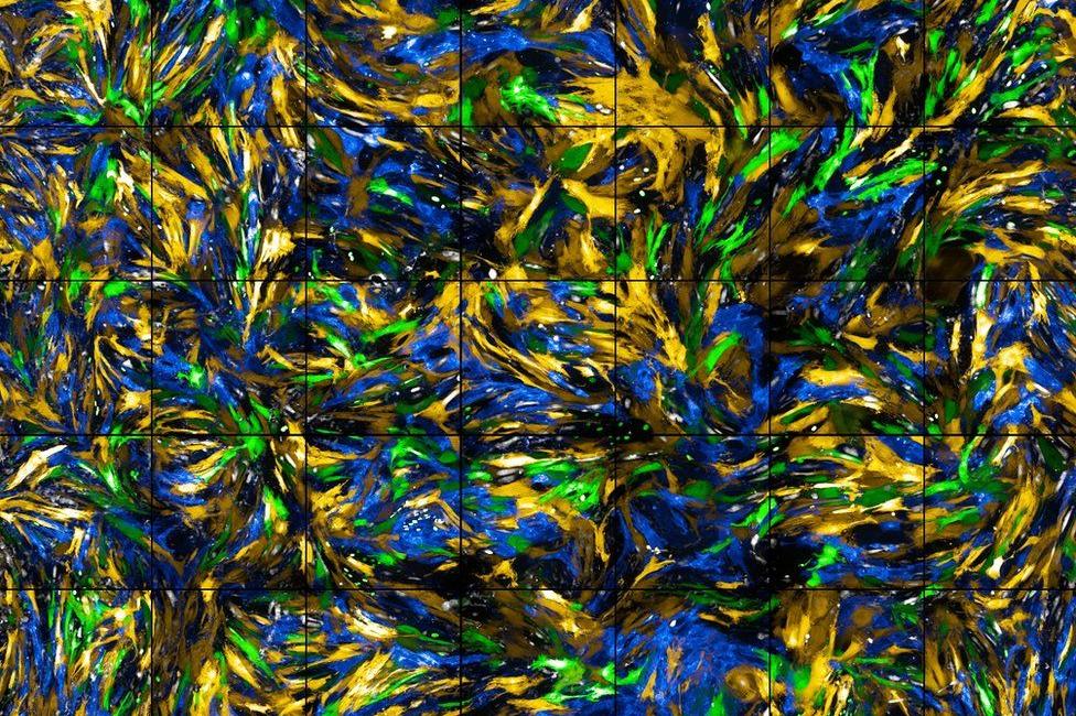 «Захватывающая драма на клеточном уровне»: на конкурсе научных снимков победила фотография клеток кровеносных сосудов 