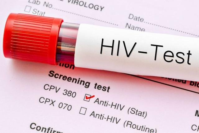 Впервые за 20 лет: в Африке найден новый штамм ВИЧ