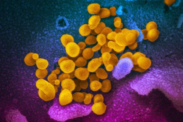 Врага надо знать в лицо: как в действительности выглядит коронавирус под микроскопом