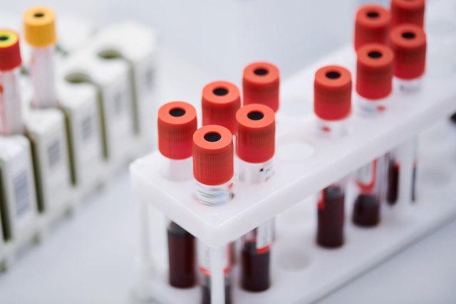 Японские ученые разработали метод диагностики 13 видов рака по капле крови