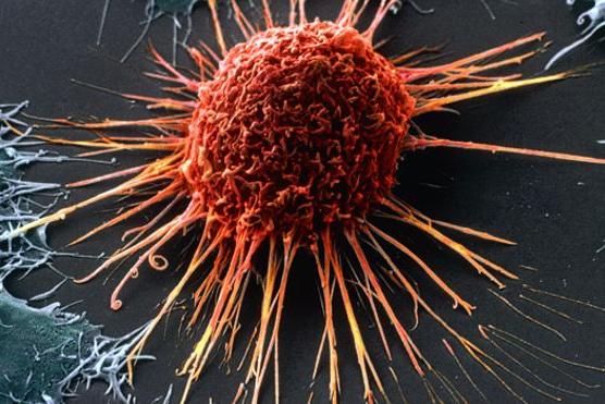 Клетки-зомби или клетки-беглецы: ученые выдвинули новую гипотезу причин рака