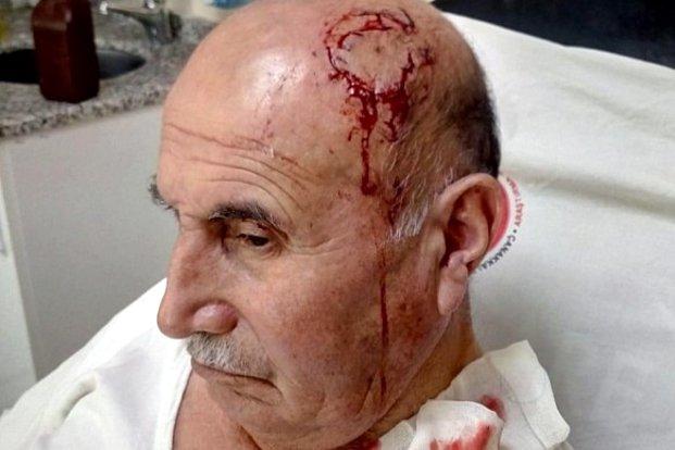 Преступление на почве ненависти: разговор на курдском стал причиной избиения пожилого человека в Турции
