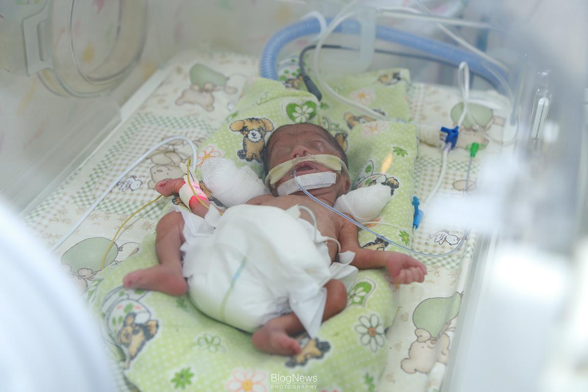 «Սլավմեդ» ԲԿ-ում փրկել են ծայրահեղ ծանր վիճակում ծնված նորածնի կյանքը