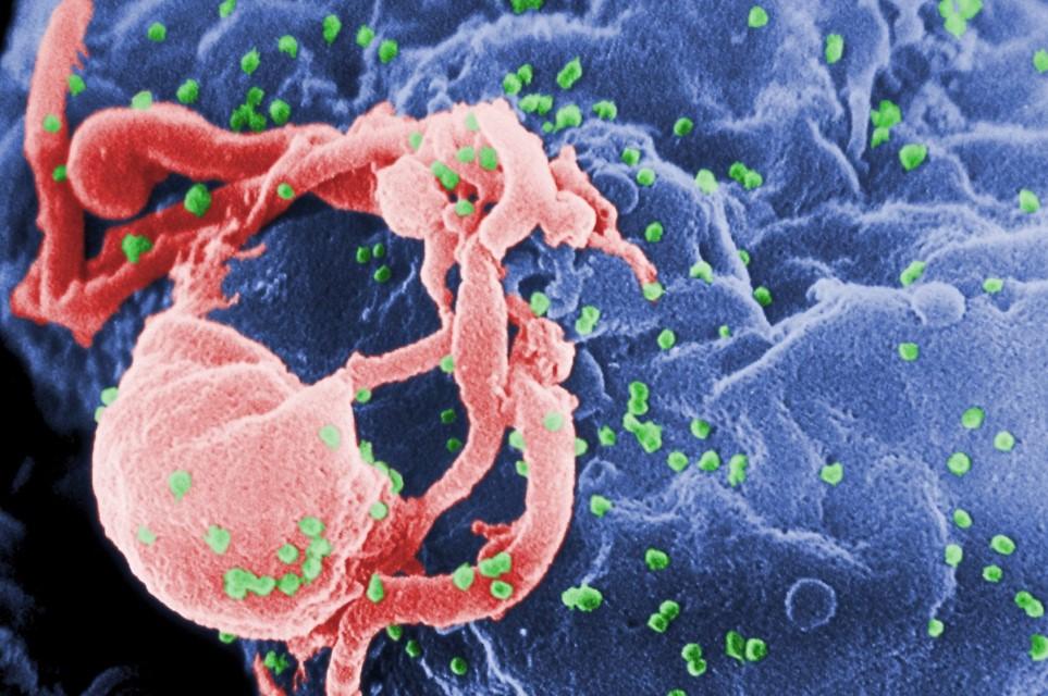 Медицина будущего: антиретровирусная терапия способствует созданию резервуара латентных форм ВИЧ