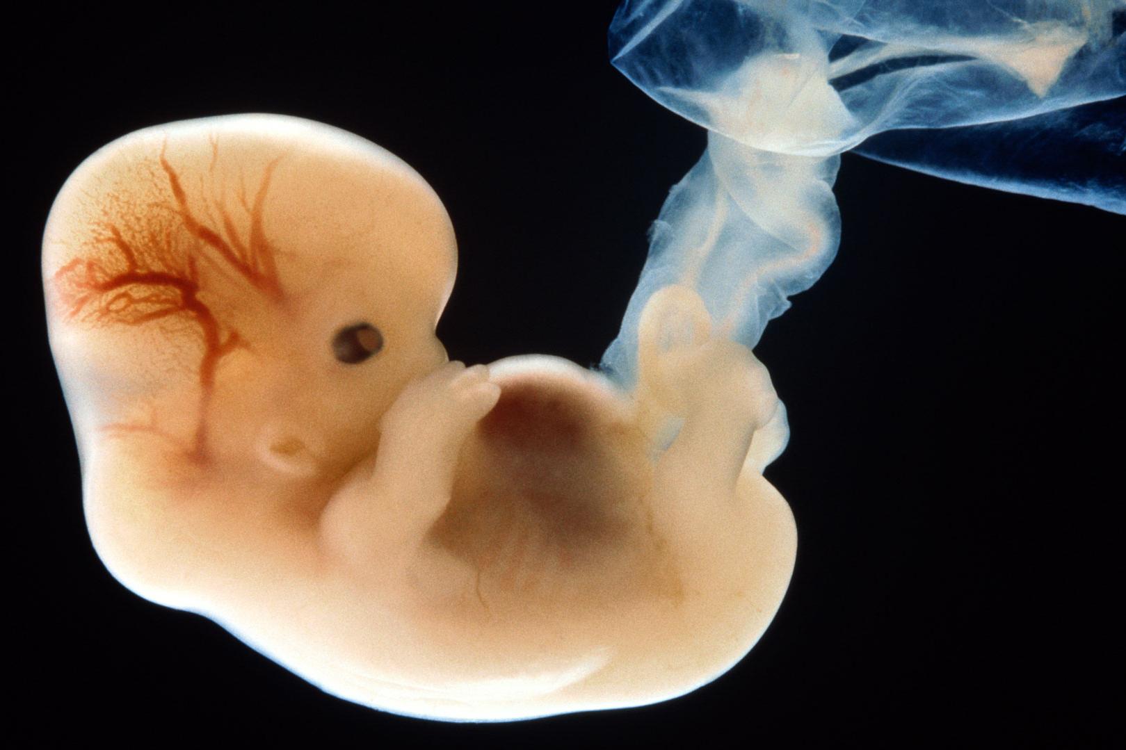 Младенцы в утробе могут видеть больше, чем считалось ранее: исследование 