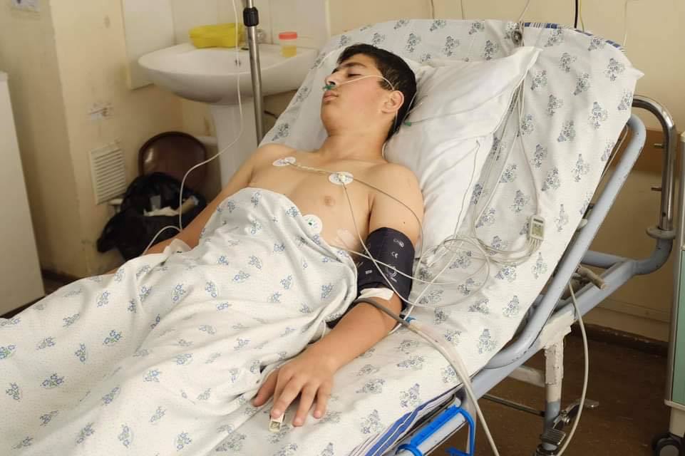 14-летний подросток получил осколочное ранение после удара азербайджанского БПЛА