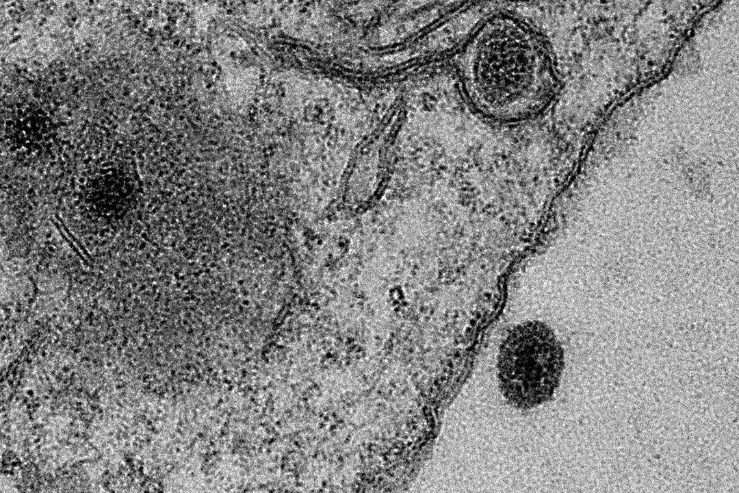 Обнаружен новый вирус, ДНК которого почти целиком состоит из генов, не имеющих аналогов в природе