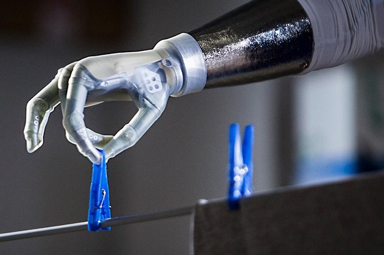 Будущее уже наступает: впервые пересажен протез с ощущением прикосновения