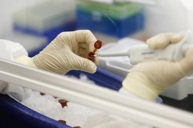 Грузинские медики подтвердили шесть смертельных случаев заболевания 