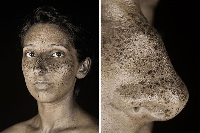 Уникальный фотопроект: УФ-портреты показали, как солнечный свет повреждает кожу